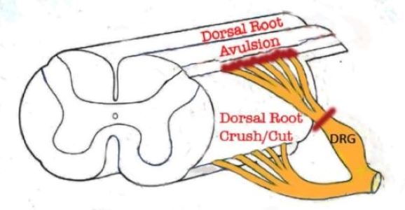 Ventral And Dorsal Roots Of The Spinal Cord GetBodySmart, 52% OFF