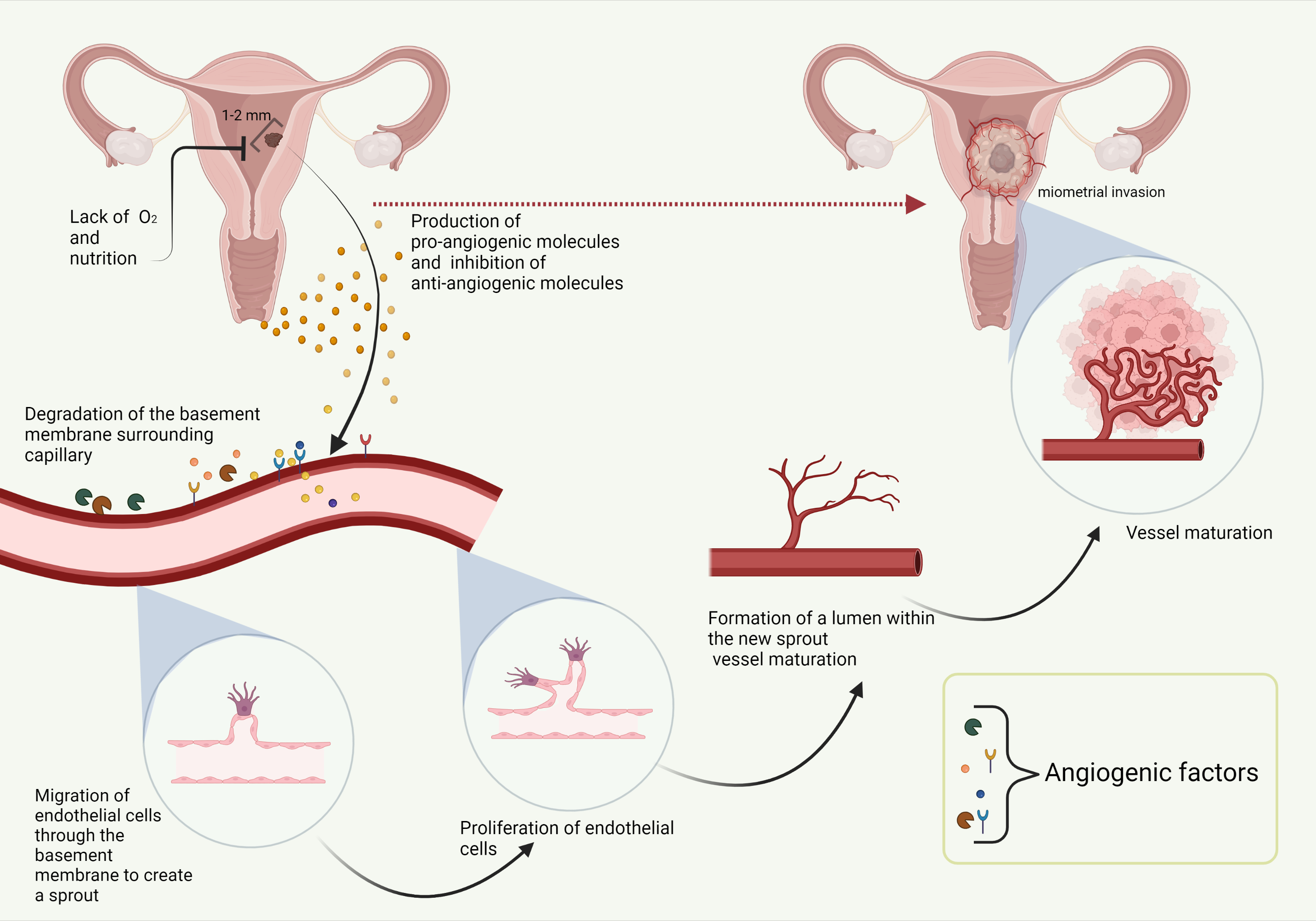 Angiogenic Factors In Endometrial Cancer Encyclopedia MDPI