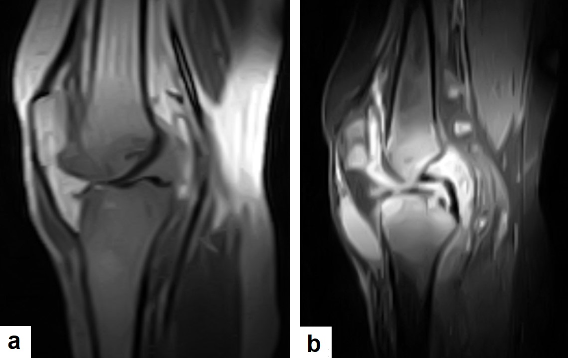 C:\Users\Admin\Documents\Term-1-1443\TB from Dr. Saif\Dr Saif images\USED IMAGES FROM DR SAIF\Knee.jpg