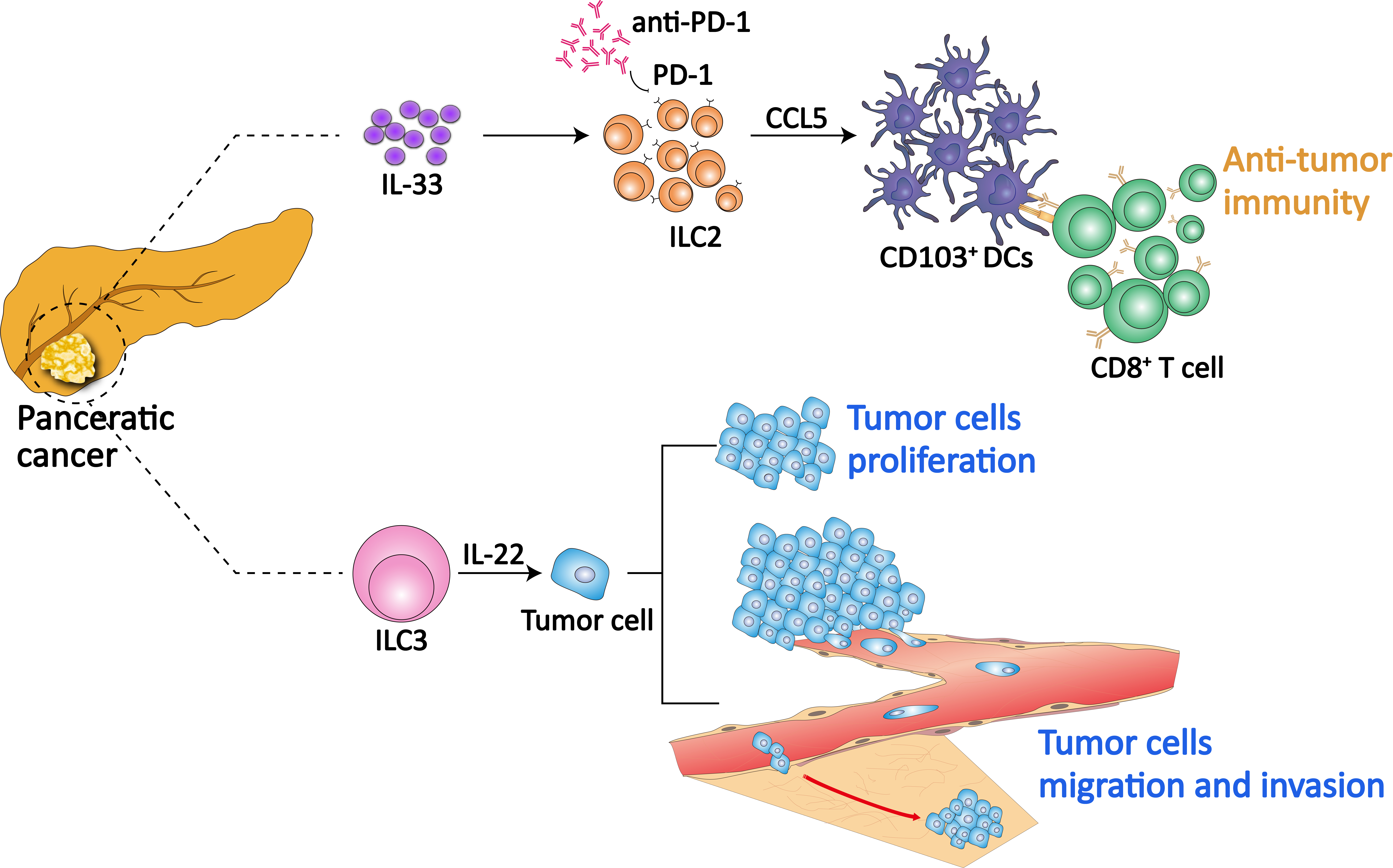 Figure 3. Role of ILCs in pancreatic cancer ILCs may act as a double-edged sword in pancreatic cancer. In PC tissues, the frequencies of ILC2s and ILC3s are both significantly increased. Expanded by IL-33, ILC2s in PC potentially produce chemokine CCL5, which promote the recruitment and accumulation of CD103+ DCs in tumor tissues and further activate antitumor immunity in CD8+T cells. ILC2s express the PD-1, which restrains antitumor immunity. However, the PD-1 inhibition on ILC2 can be relieved by antibody-mediated PD-1 blockade, identifying ILC2s to be a potential, promising and brand-new target for anti-PD-1 immunotherapy. Unlike ILC2s, ILC3s promote the proliferation, metastasis and invasion of PC cells through IL-22/AKT signaling.