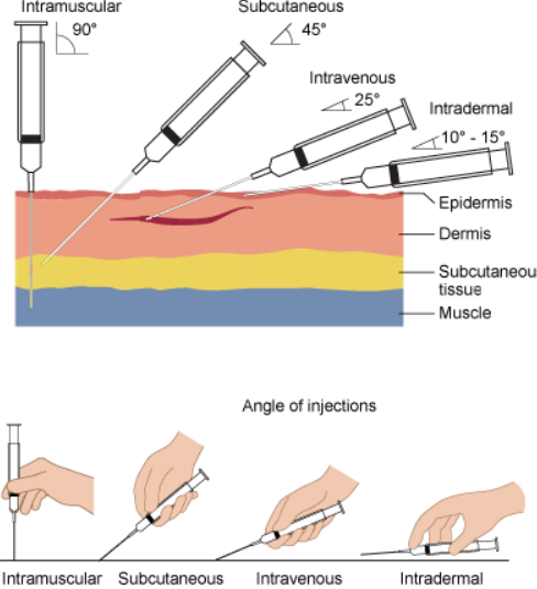Subcutaneous Injection Sites