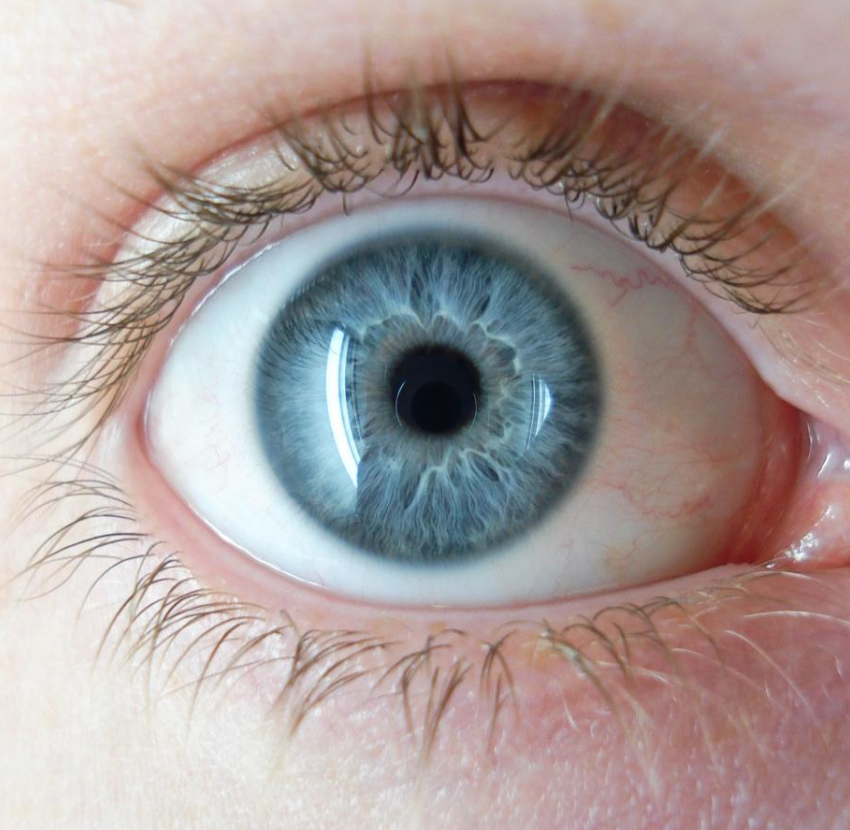 Human Eye Color  Encyclopedia MDPI