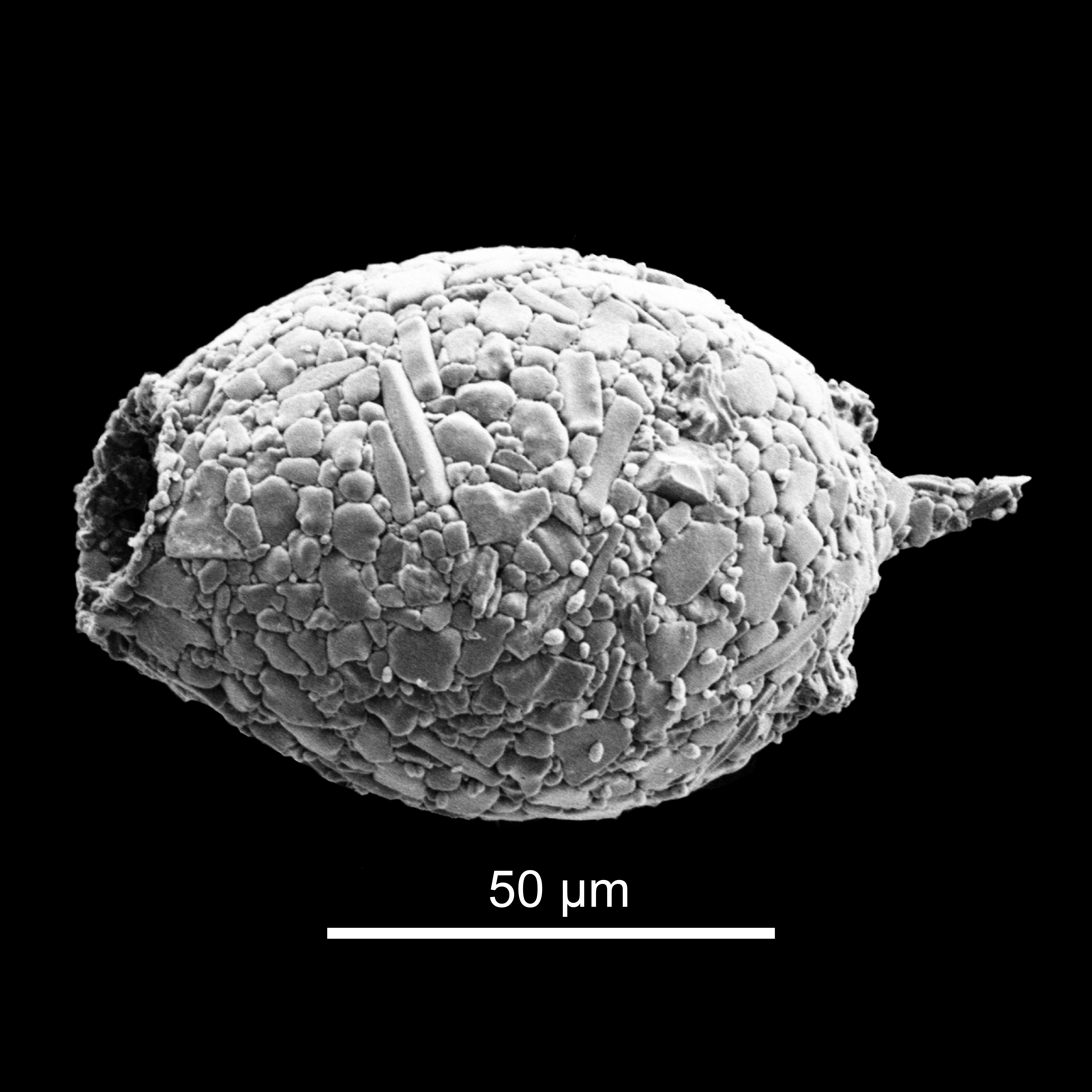 <em>Difflugia australis</em> (Playfair, 1917) Gauthier-Lièvre et Thomas, 1958