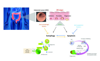 Apoptosis and Autophagy in the Development of Human Colorectal Cancer