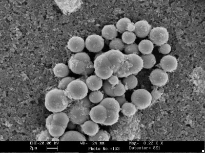 Cobalt Nanoparticles Prepared by the Polyol Process