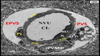 TEM of Neurovascular Unit and Perivascular Unit
