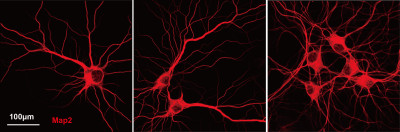 Mouse Primary Cultured Hippocampal Neurons