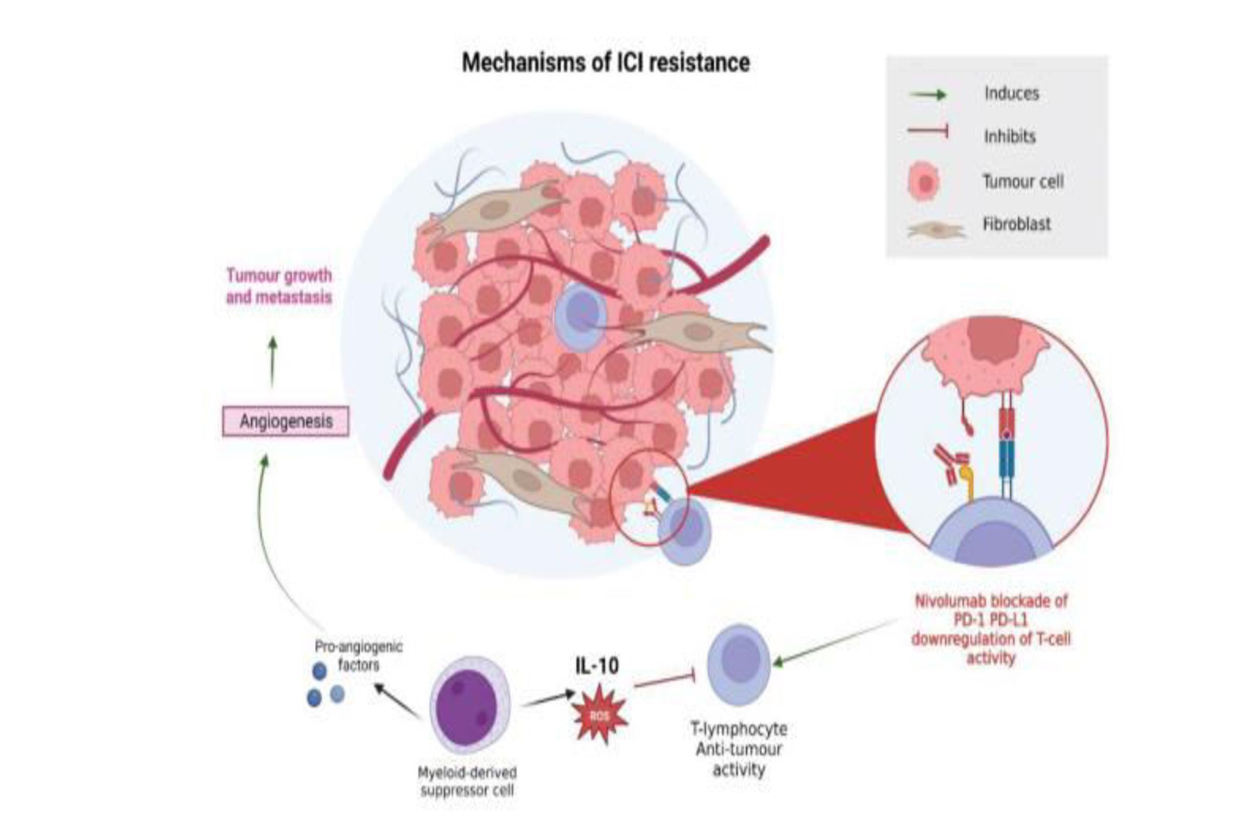 Mechanisms Of Action And Drug Resistance Of Nivolumab In RCC 