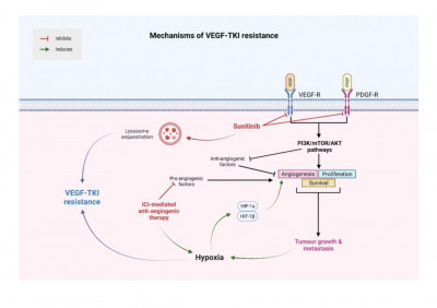 Renal Cell Cancer – Insights in Drug Resistance Mechanisms