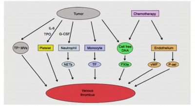 Thrombosis in Cancer