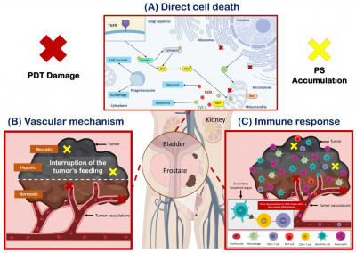 Photodynamic Therapy Destroys Tumor Cells by Three Mechanisms of Action