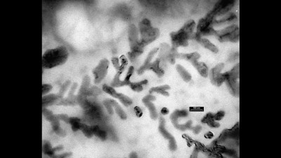 Transmission Electron Microscopy Micrograph of Magnetite Nanoparticles Dentritic Structures