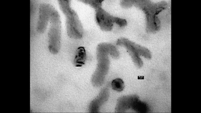 TEM Micrograph of Dendritic Structures Generate by Magnetite Nanoparticles