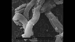 Scanning Electron Microscopy (SEM) Micrograph of Expanded Graphite