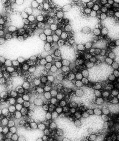 Yellow Fever Virus Virions