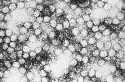 Yellow Fever Virus Virions