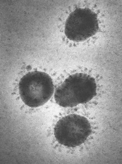 Infectious Bronchitis Virus