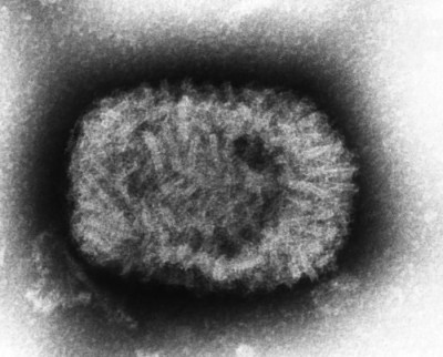 Electron Micrograph of a Smallpox (Variola) Virus Particle