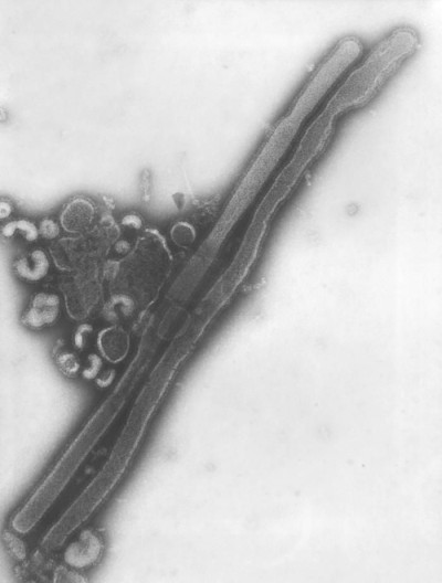 A Orthomyxoviridae Virus Family Member