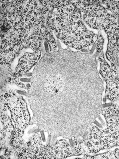 Transmission Electron Micrograph of Lagos Bat Virus