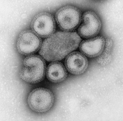 Transmission Electron Micrograph of Influenza Virus