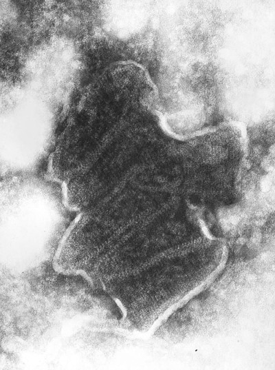 Transmission Electron Micrograph of Bovine Ephemeral Fever Virus