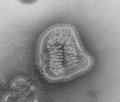 Transmission Electron Micrograph of an Influenza Virus Particle