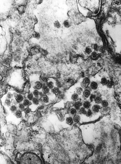 Transmission Electron Micrograph of Spumavirus