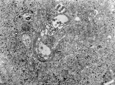 TEM of a Tissue Infected with Rift Valley Fever Virus