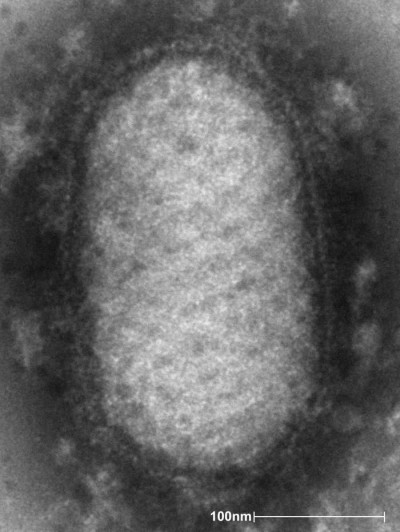 Negative-Stained Transmission Electron Micrograph of an Orf Virus