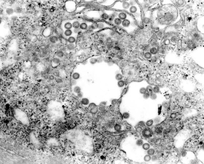 Transmission Electron Micrograph of Rift Valley Fever Virus