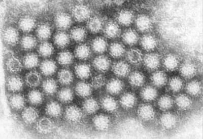 Ultrastructural Morphology of Norovirus