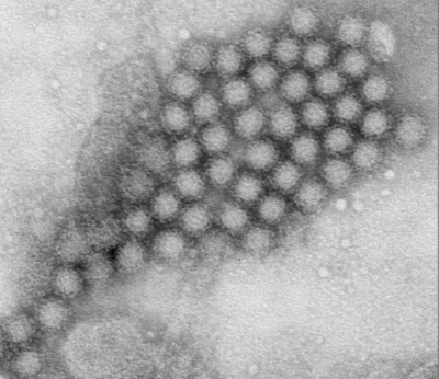 A Cluster of Norovirus Virions