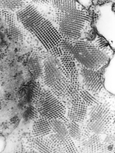 Transmission Electron Micrograph of Nodamura Virus