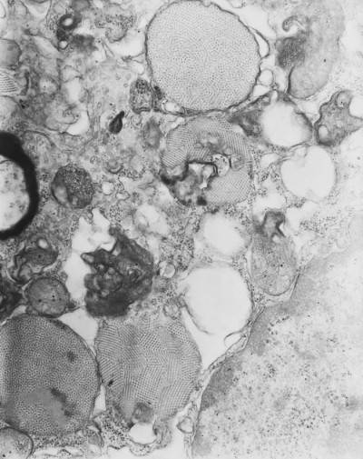 Transmission Electron Micrograph of Nodamura Virus