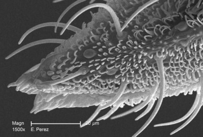 Magnified 1500X, Minute Exoskeletal Details of An Unidentified Mosquito