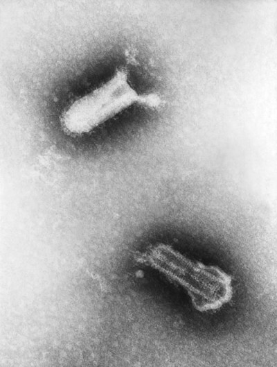 Transmission Electron Micrograph of Two Piry Virus Birions