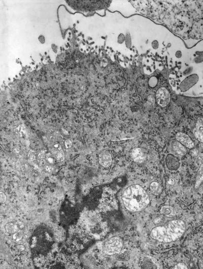 Transmission Electron Micrograph of Numerous Piry Virus Virions