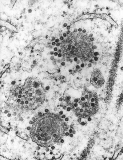 Transmission Electron Micrograph of Eastern Equine Encephalitis Virus Virions