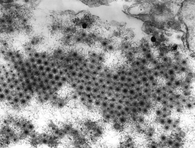 Transmission Electron Micrograph of Reovirus Type-3 Virions