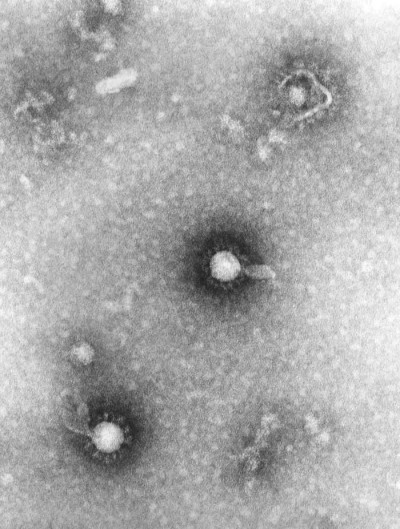 Transmission Electron Micrograph of Eastern Equine Encephalitis Virus Virions