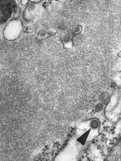 Transmission Electron Micrograph of Rabies Virion