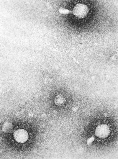 Transmission Electron Micrograph Venezuelan Equine Encephalitis Virus Virions