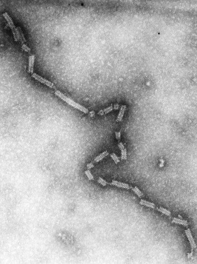 Transmission Electron Micrograph of Human Parainfluenza Virus Type-4a