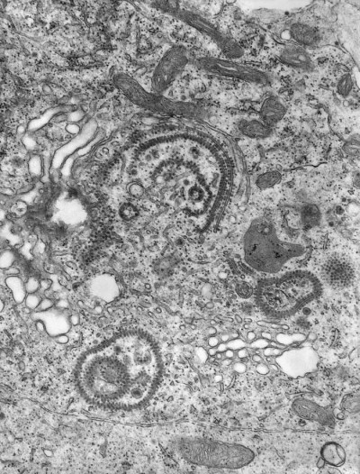 Transmission Electron Micrograph of Eastern Equine Encephalitis Virus Virions