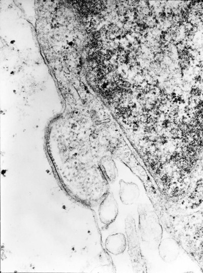 Transmission Electron Micrograph of Human Parainfluenza Type 4A Virus