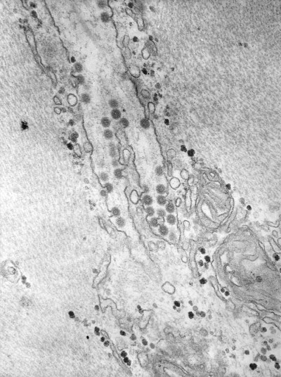 Transmission Electron Micrograph of Semliki Forest Virus Virions