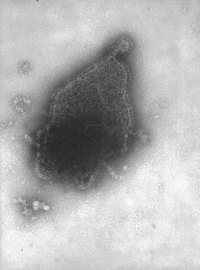 Transmission Electron Micrograph of Human Parainfluenza Type 4A Virus