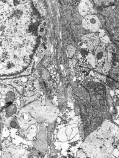 Transmission Electron Micrograph of Eastern Equine Encephalitis Virus Virions