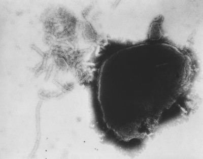 Transmission Electron Micrograph of Numerous Paramyxovirus